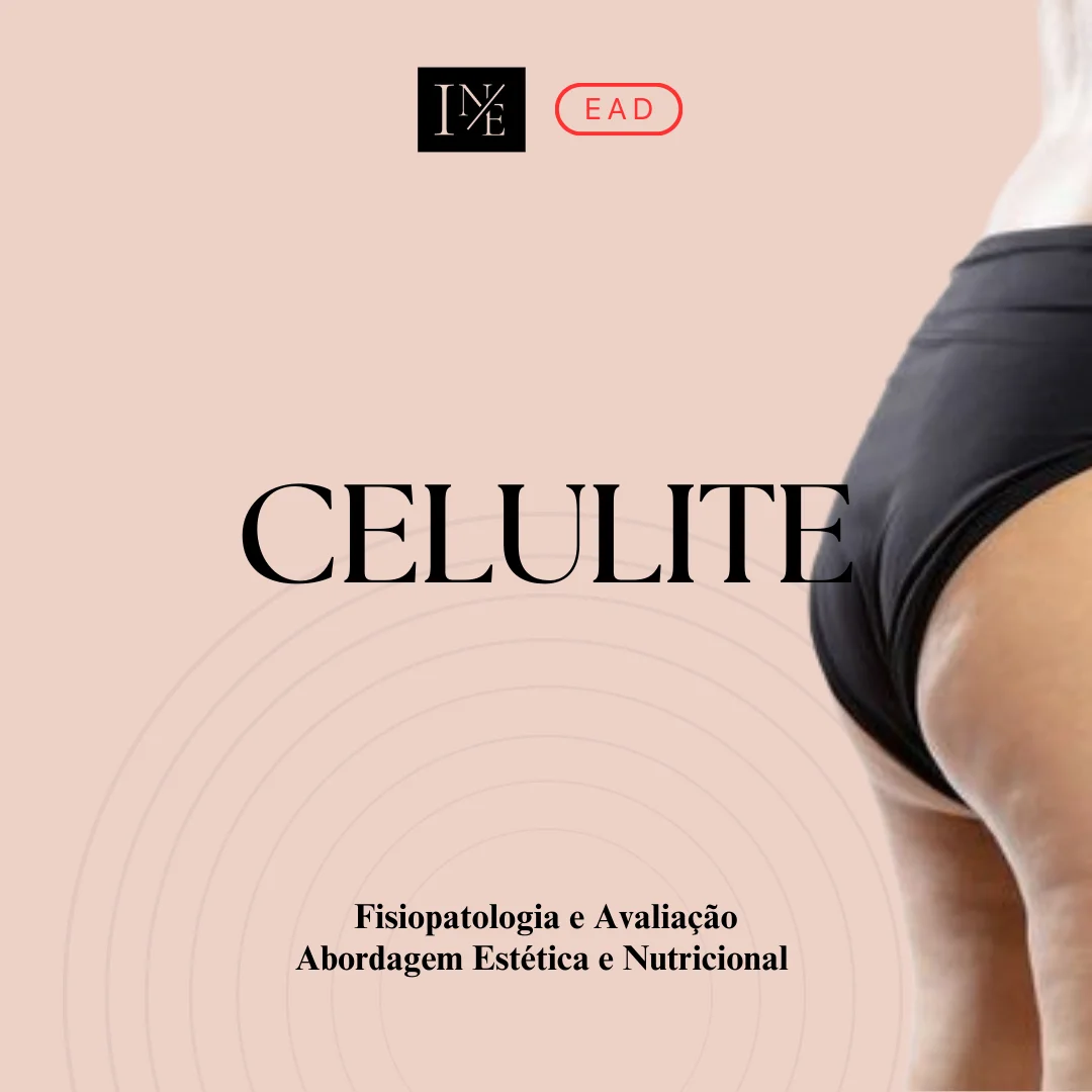 Capa do curso Celulite — Abordagem Estética e Nutricional