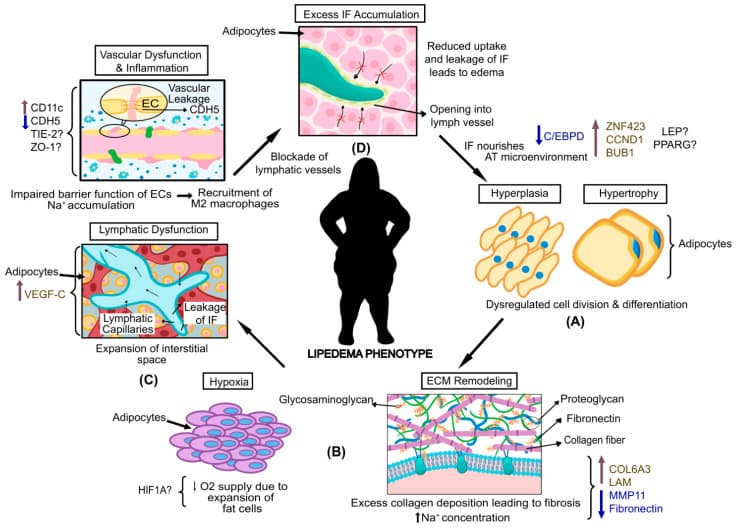 Figura científica do manual: base genética e poligênica do lipedema — vias metabólicas e genes candidatos.